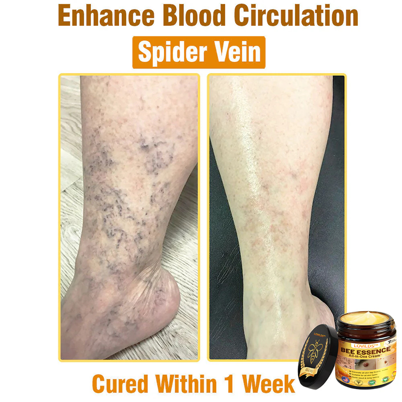 LOVILDS™ Bee Essence All-in-One Cream US Dermatologist Approved