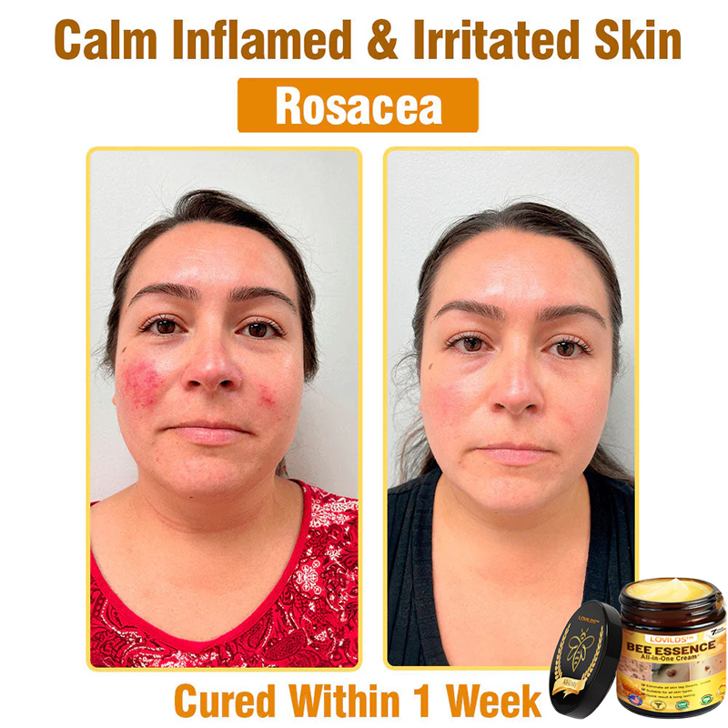 LOVILDS™ Bee Essence All-in-One Cream US Dermatologist Approved