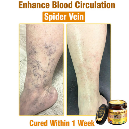 LOVILDS™ Bee Essence All-in-One Cream US Dermatologist Approved