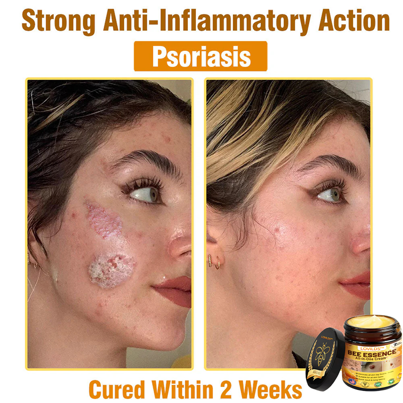 LOVILDS™ Bee Essence All-in-One Cream US Dermatologist Approved