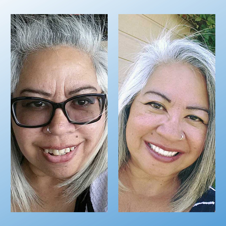 𝗠𝗲𝗱𝗶𝗰𝗮𝗹-𝗚𝗿𝗮𝗱𝗲 𝗙𝘂𝗻𝗰𝘁𝗶𝗼𝗻𝗮𝗹 𝗧𝗵𝗶𝗰𝗸𝗲𝗻𝗲𝗱 𝗗𝗲𝗻𝘁𝘂𝗿𝗲𝘀🗽𝗠𝗮𝗱𝗲 𝗜𝗻 𝗧𝗵𝗲 𝗨𝗦𝗔👏
