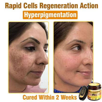 LOVILDS™ Bee Essence All-in-One Cream US Dermatologist Approved