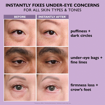 🌸 Last 3 Hours:🔥 Up to 15% OFF – Instant Eye Tightener Easy-Wear Formula✨-